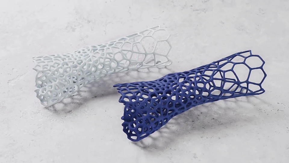 Attelles en structure lattice issues de conception générative, imprimées en 3D