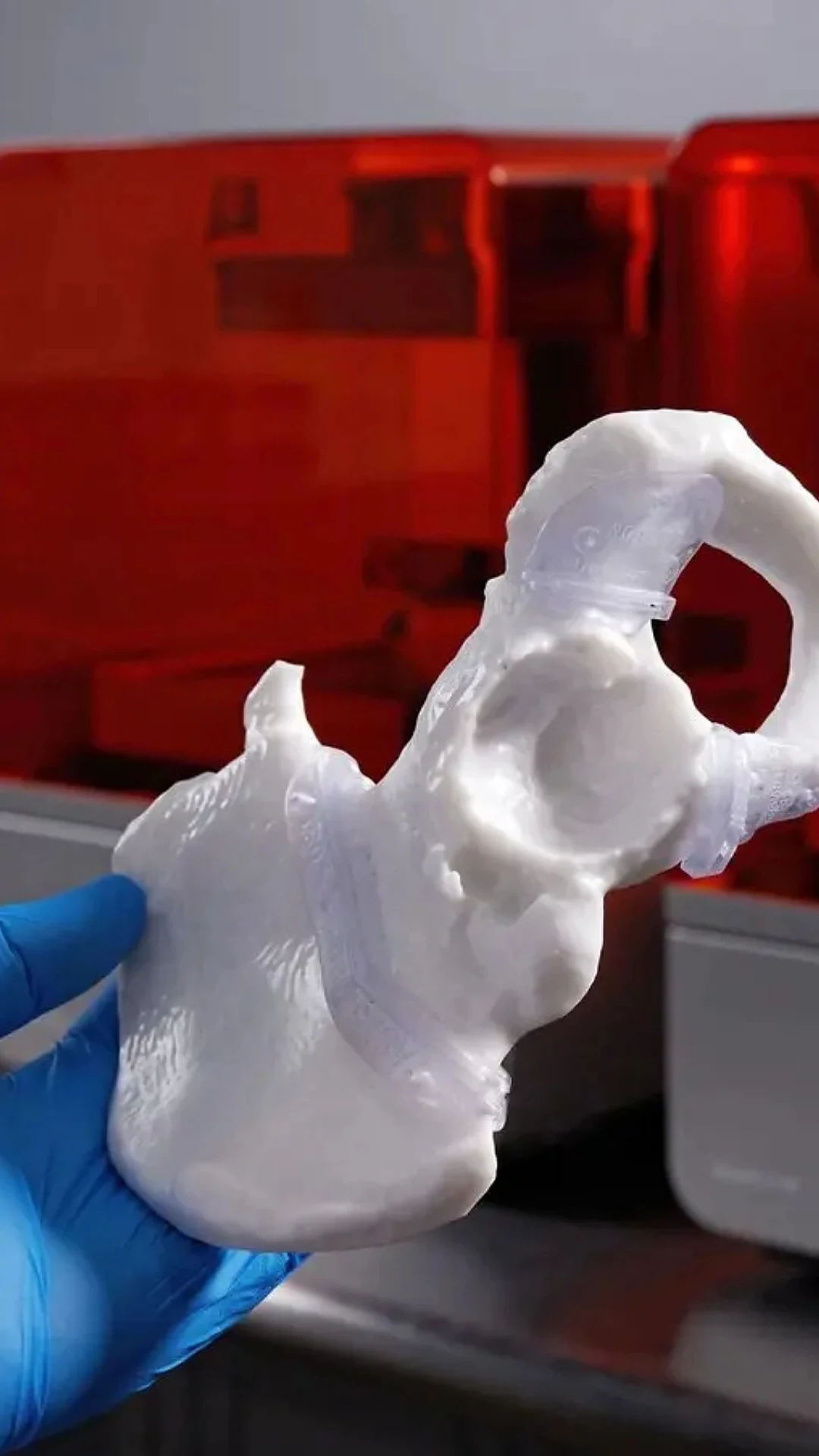 Modèle anatomique de hanche imprimé en 3D SLA pour préparation chirurgicale